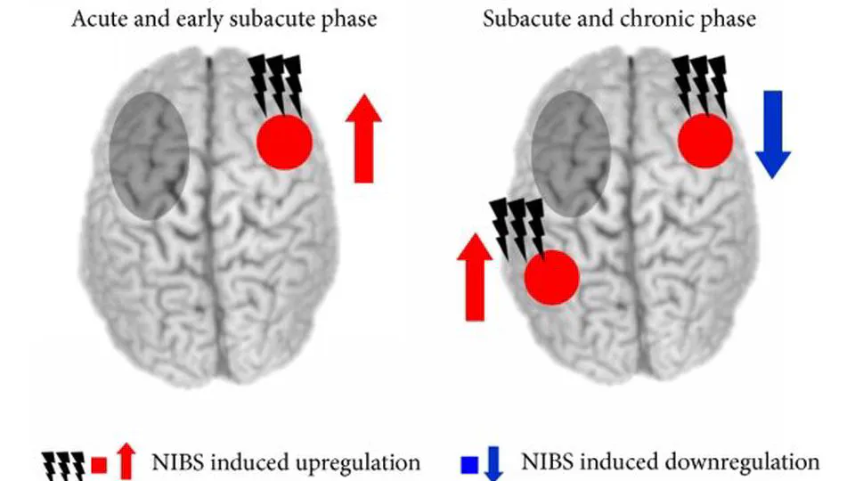 📚 New article out in Brain & Language