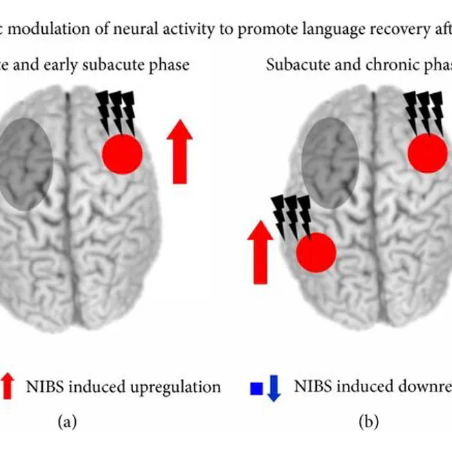 📚 New article out in Brain & Language