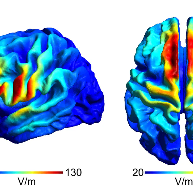 Advancing the Application of TMS in neurocognitve research and beyond