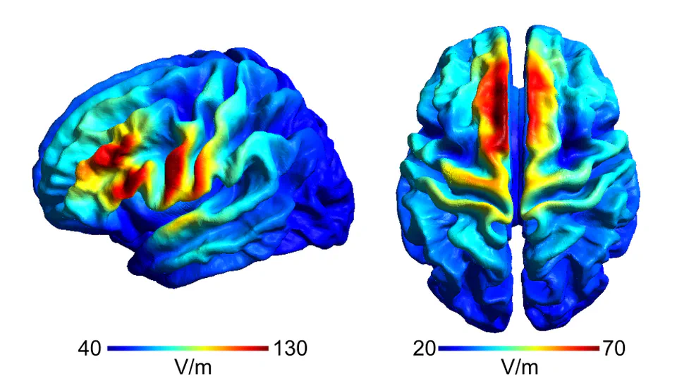 Advancing the Application of TMS in neurocognitve research and beyond